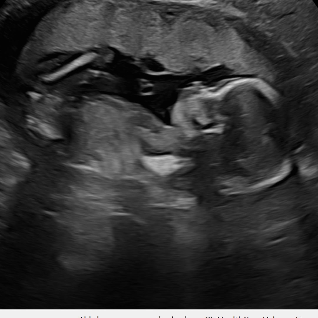 Photo shared by Stephanie for their Babylist baby registry.