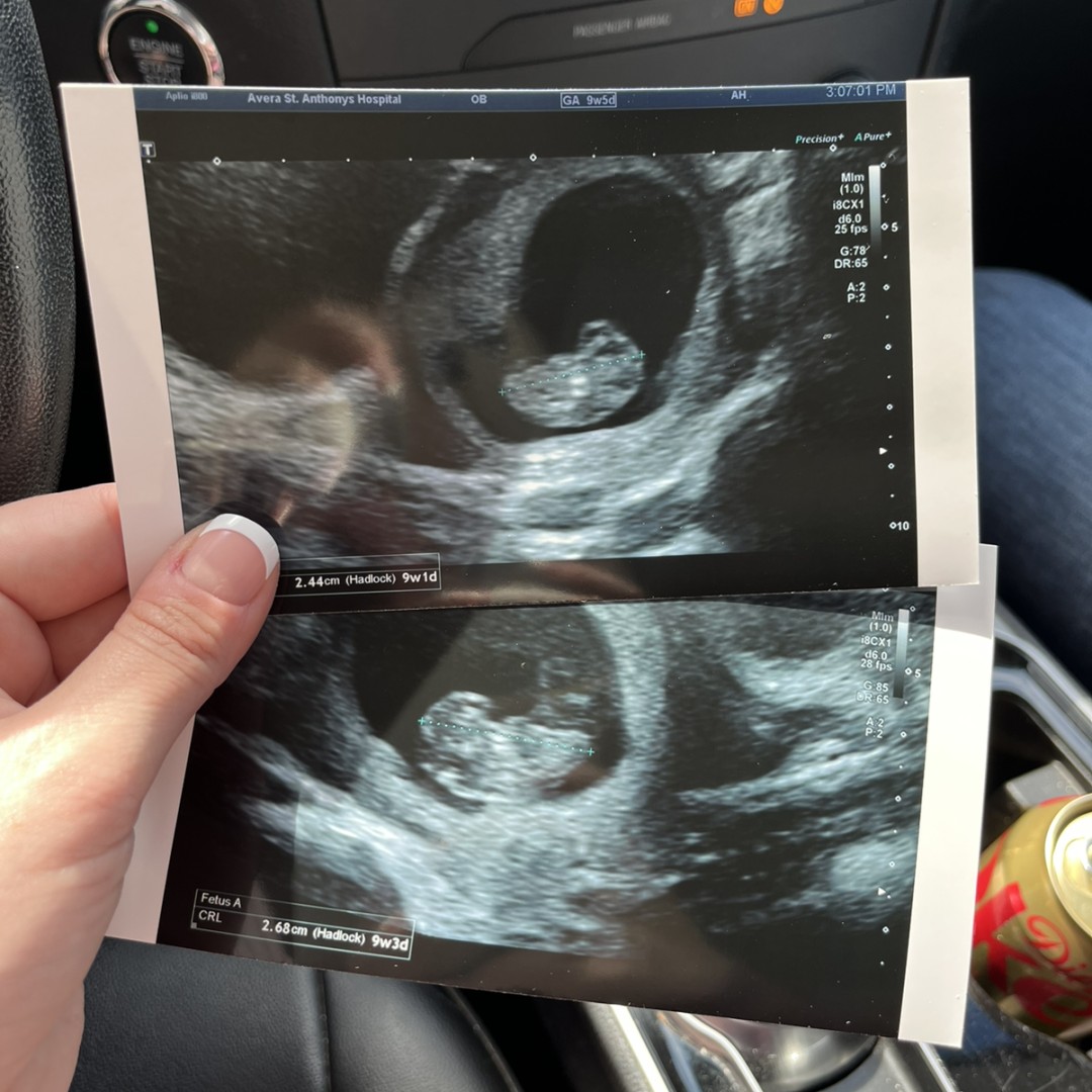 Photo shared by Nicole for their Babylist baby registry.