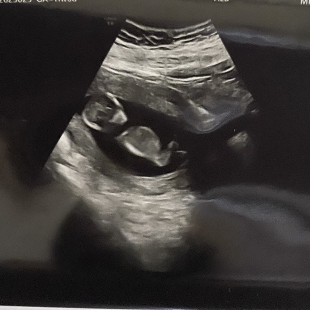 Photo shared by Ashley for their Babylist baby registry.