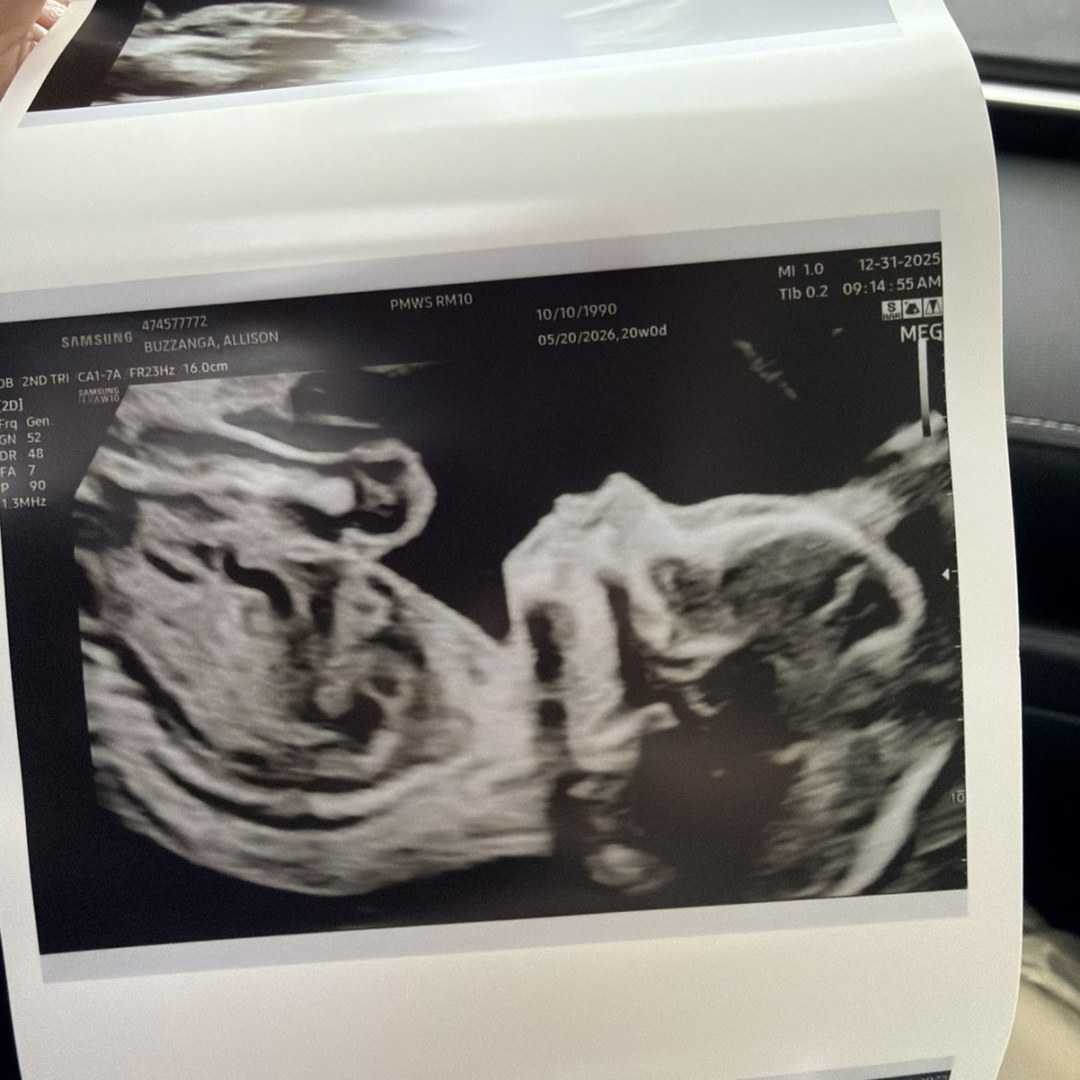 Photo shared by Ally for their Babylist baby registry.