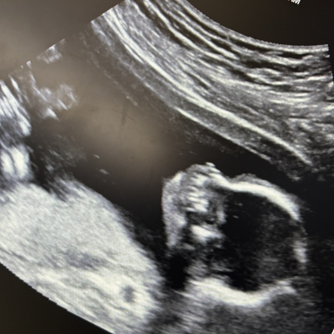 Photo shared by Megan for their Babylist baby registry.