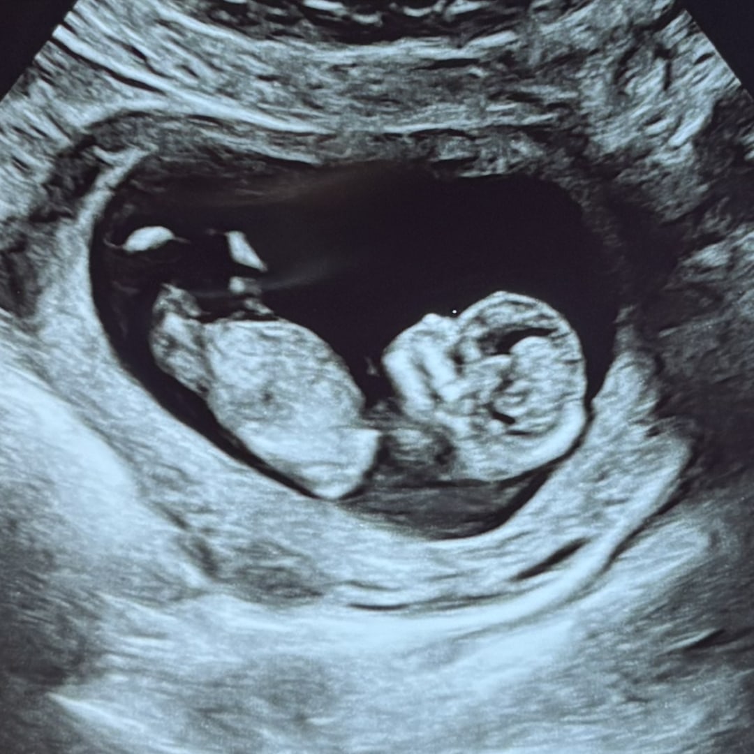 Photo shared by Kristina for their Babylist baby registry.