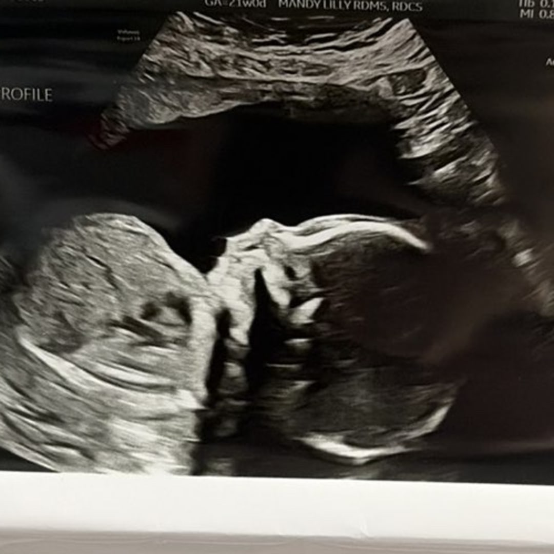 Photo shared by Kayla for their Babylist baby registry.