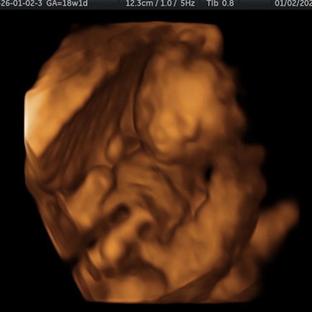 Photo shared by Zoe for their Babylist baby registry.