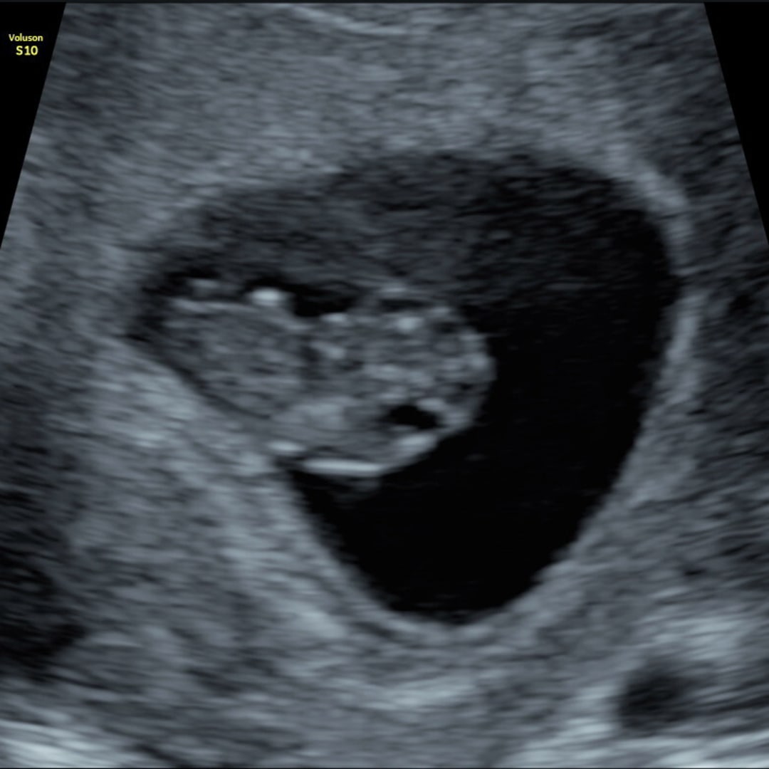 Photo shared by Brynn for their Babylist baby registry.
