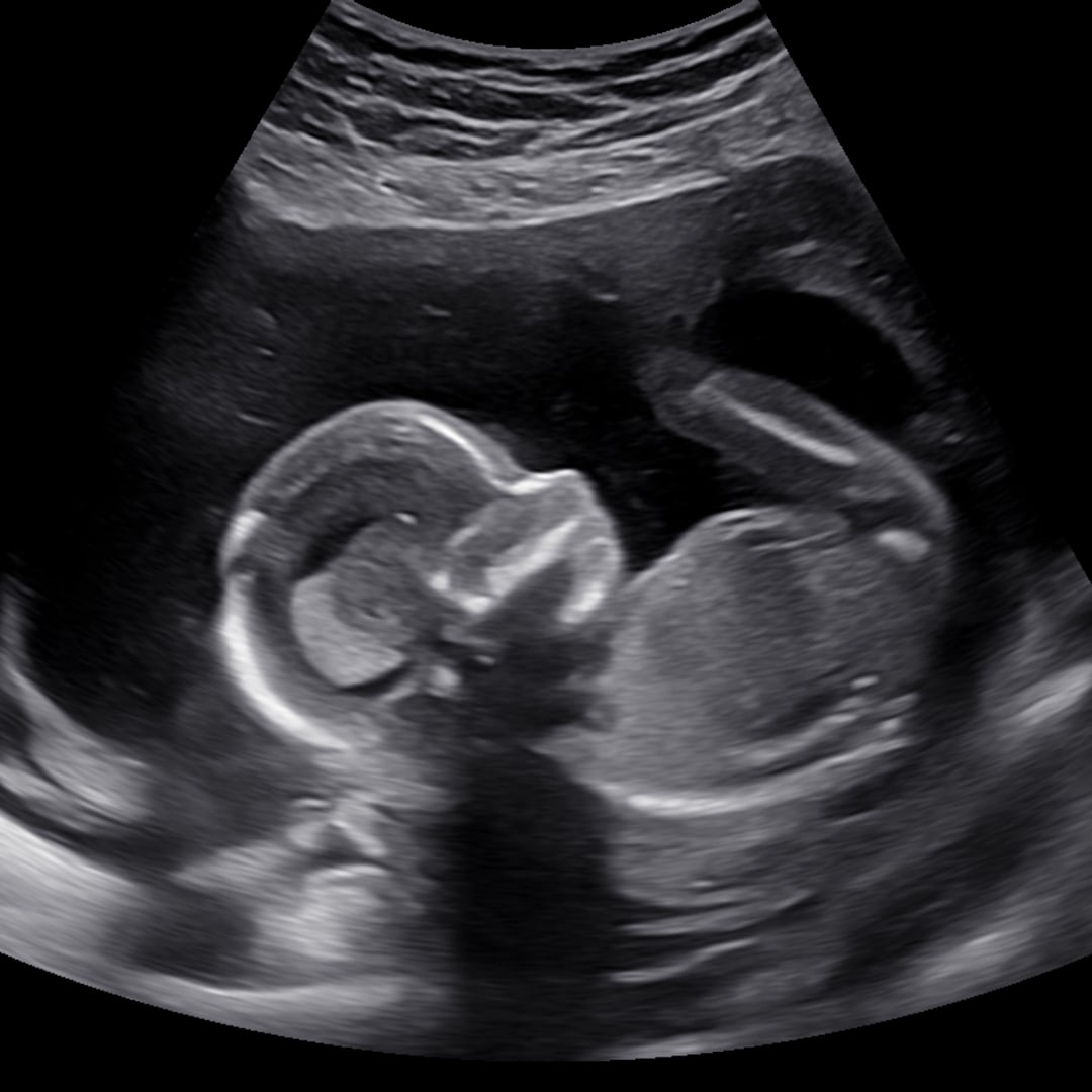 Photo shared by Courtney for their Babylist baby registry.