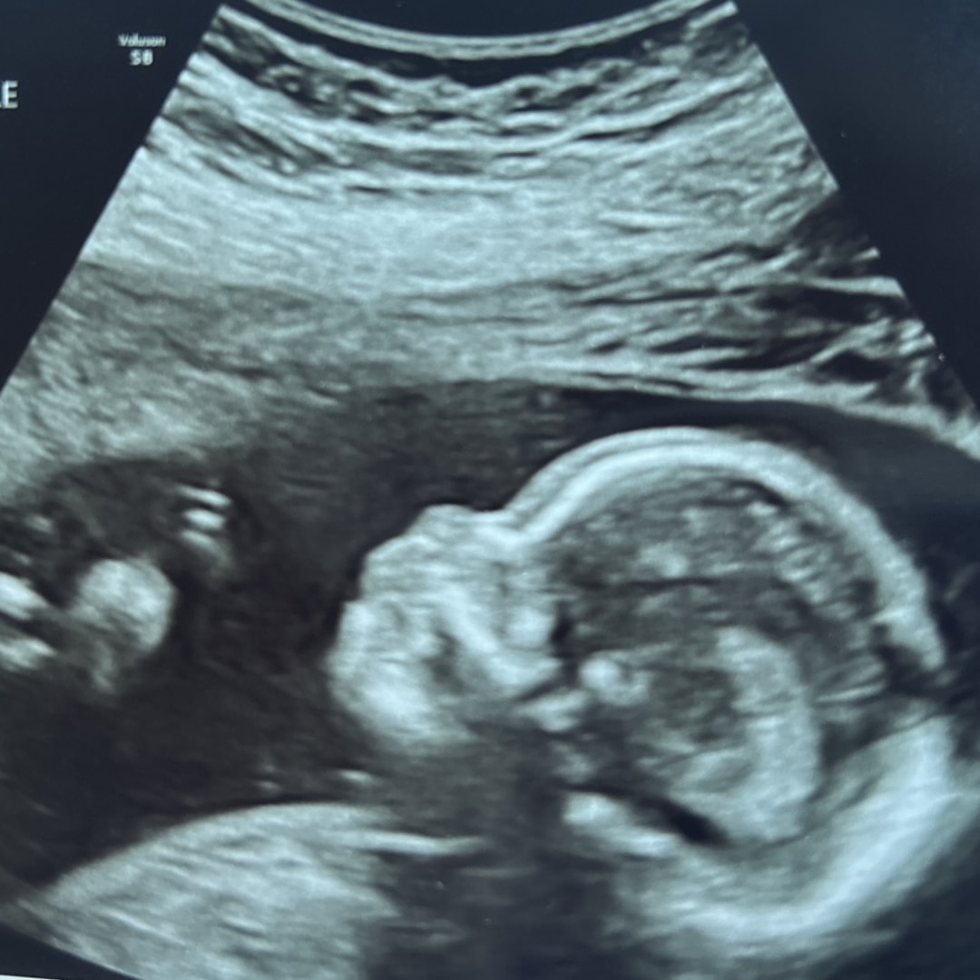 Photo shared by Ryleigh for their Babylist baby registry.