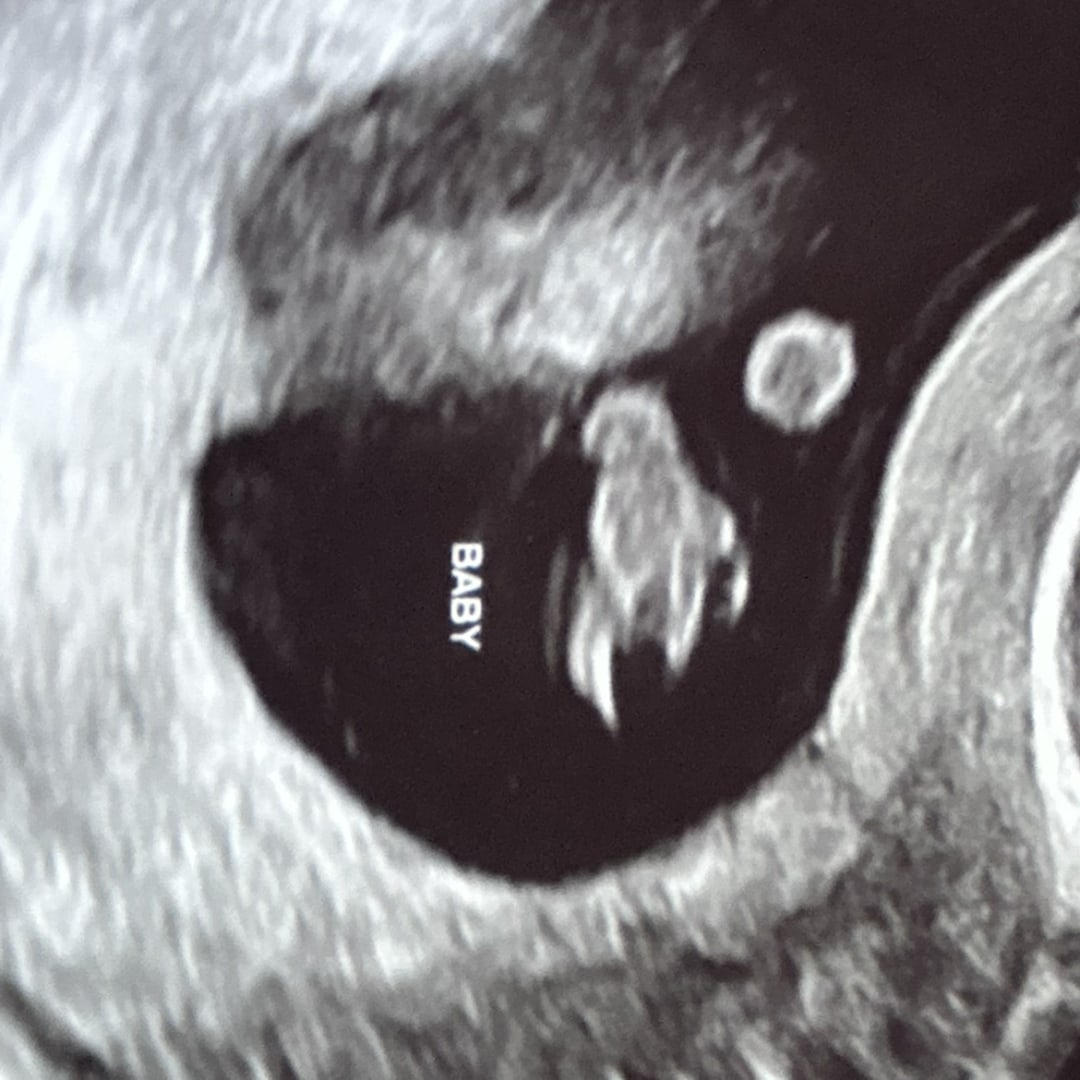 Photo shared by Jessica for their Babylist baby registry.