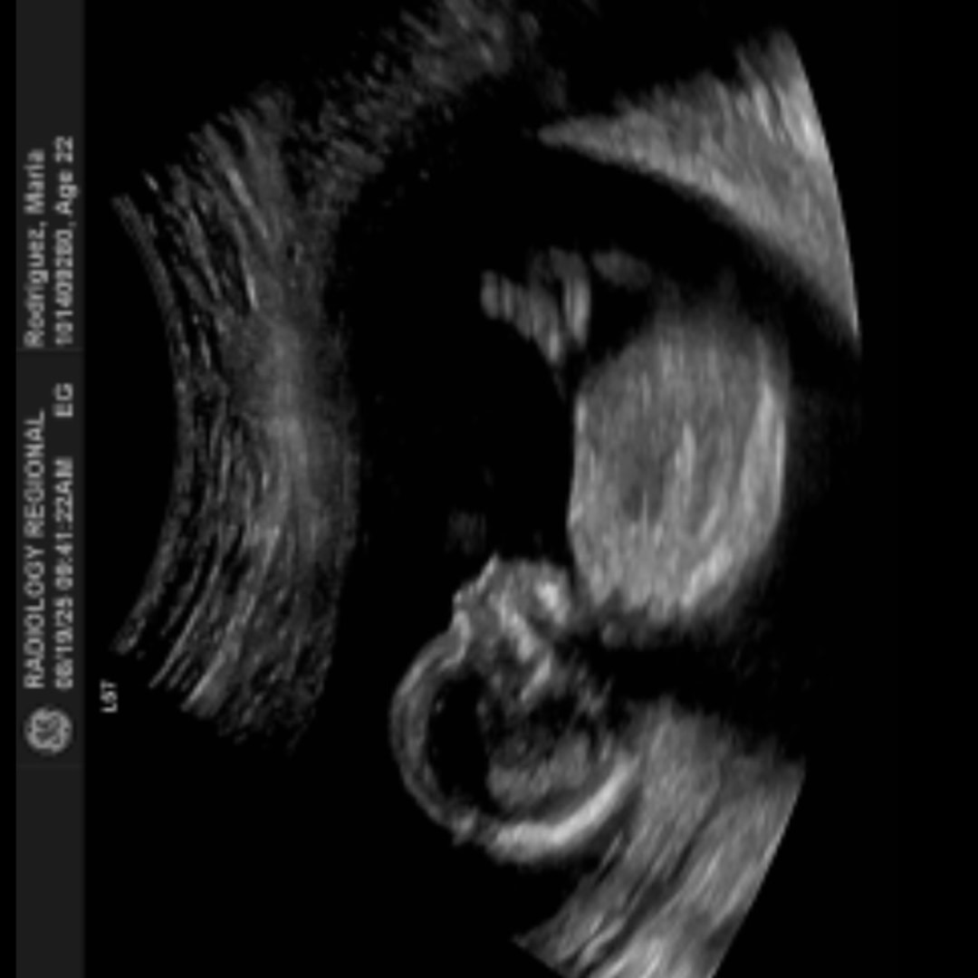 Photo shared by Maria Karla for their Babylist baby registry.