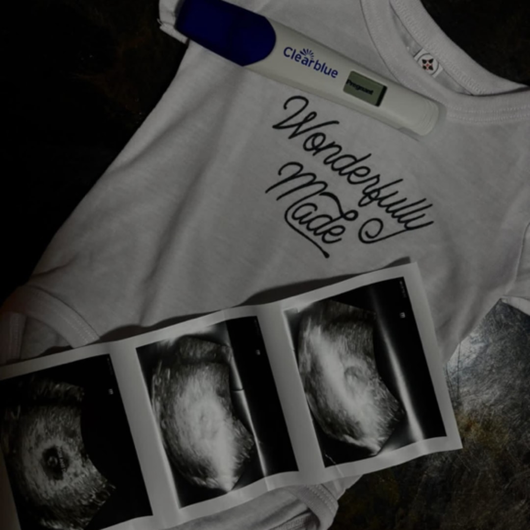 Photo shared by Brooklyn for their Babylist baby registry.