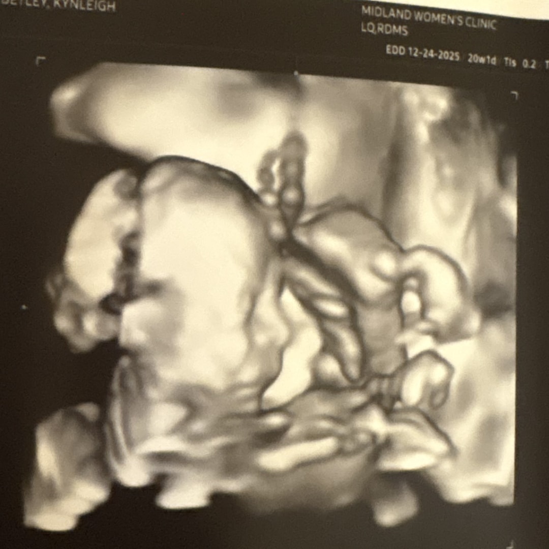 Photo shared by Kynleigh for their Babylist baby registry.
