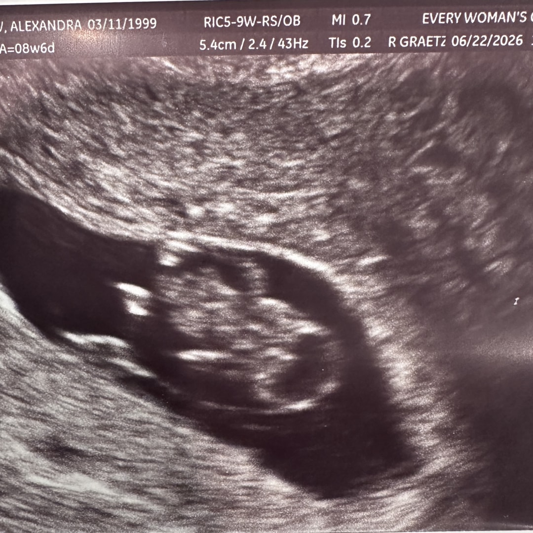 Photo shared by Alexandra for their Babylist baby registry.
