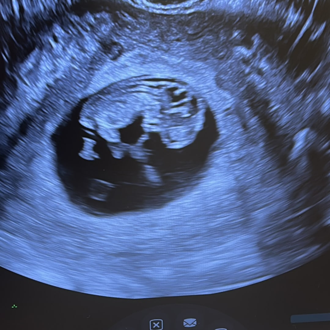 Photo shared by Dana for their Babylist baby registry.
