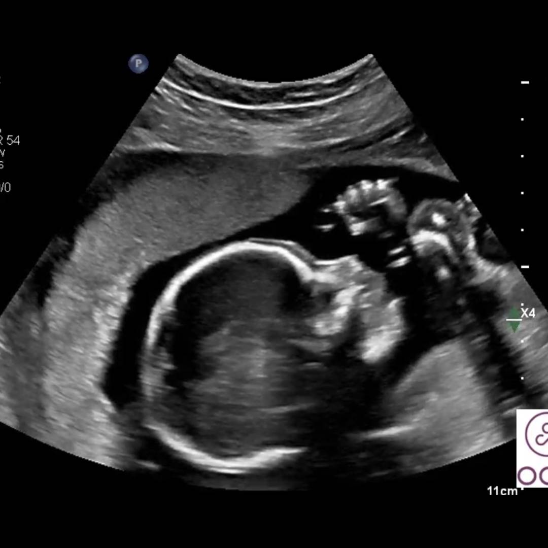 Photo shared by Angey for their Babylist baby registry.