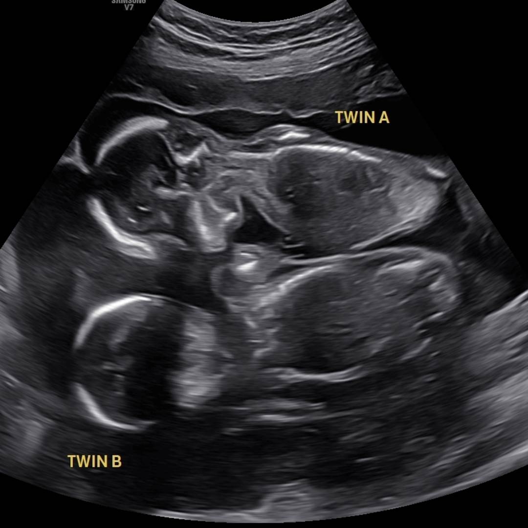 Photo shared by Carrie for their Babylist baby registry.