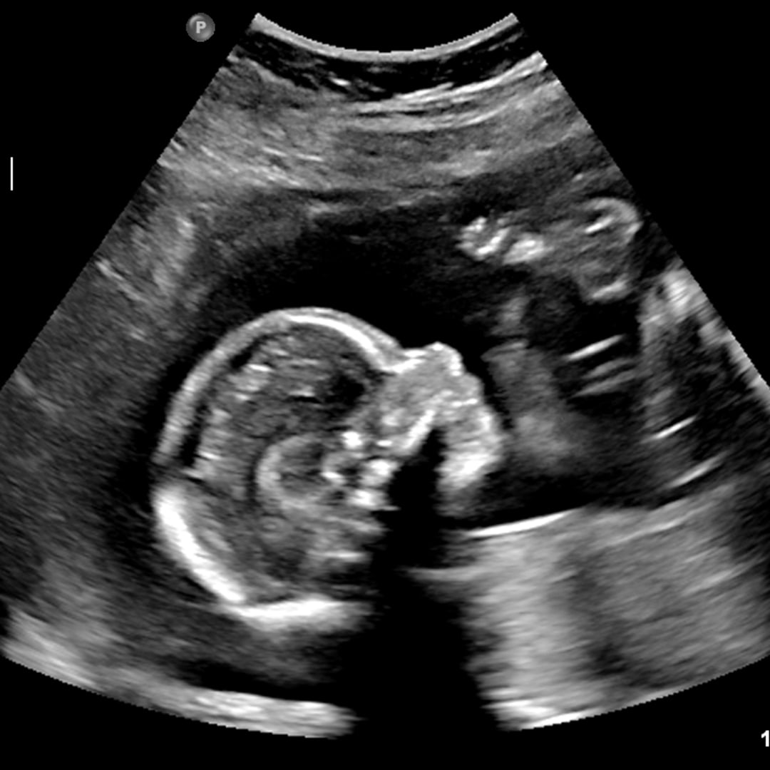 Photo shared by Courtney for their Babylist baby registry.