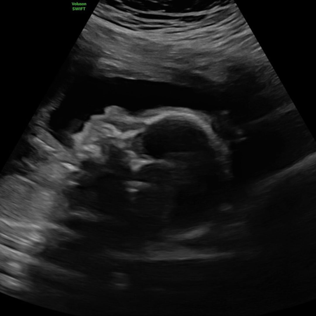 Photo shared by Julissa for their Babylist baby registry.