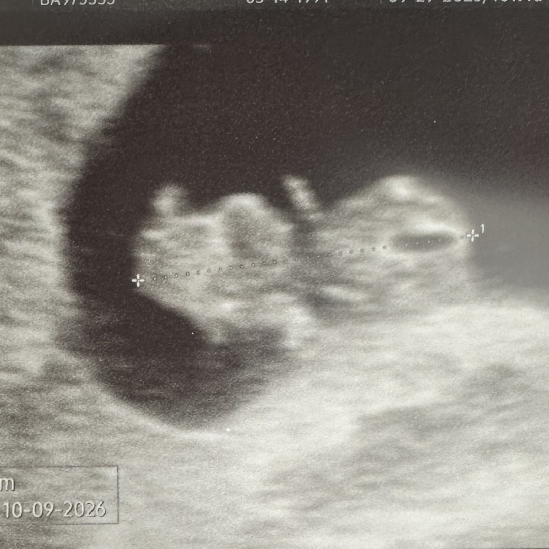 Photo shared by Amethyst for their Babylist baby registry.