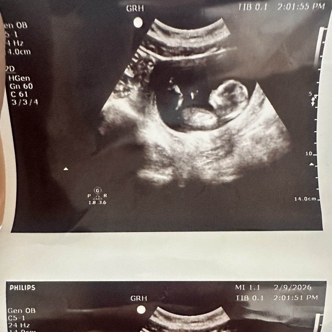 Photo shared by Alayne for their Babylist baby registry.