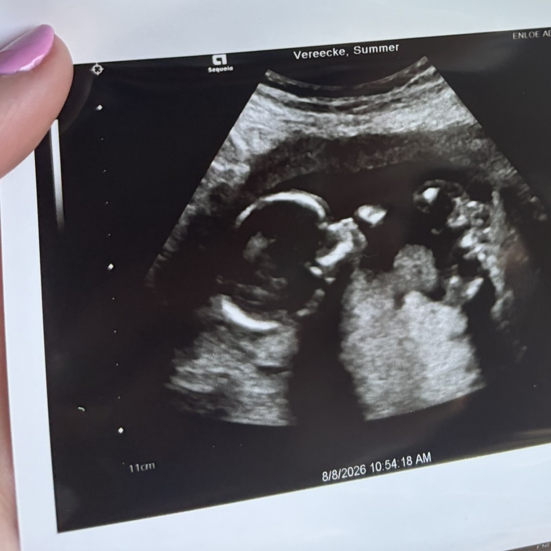 Photo shared by Summer for their Babylist baby registry.
