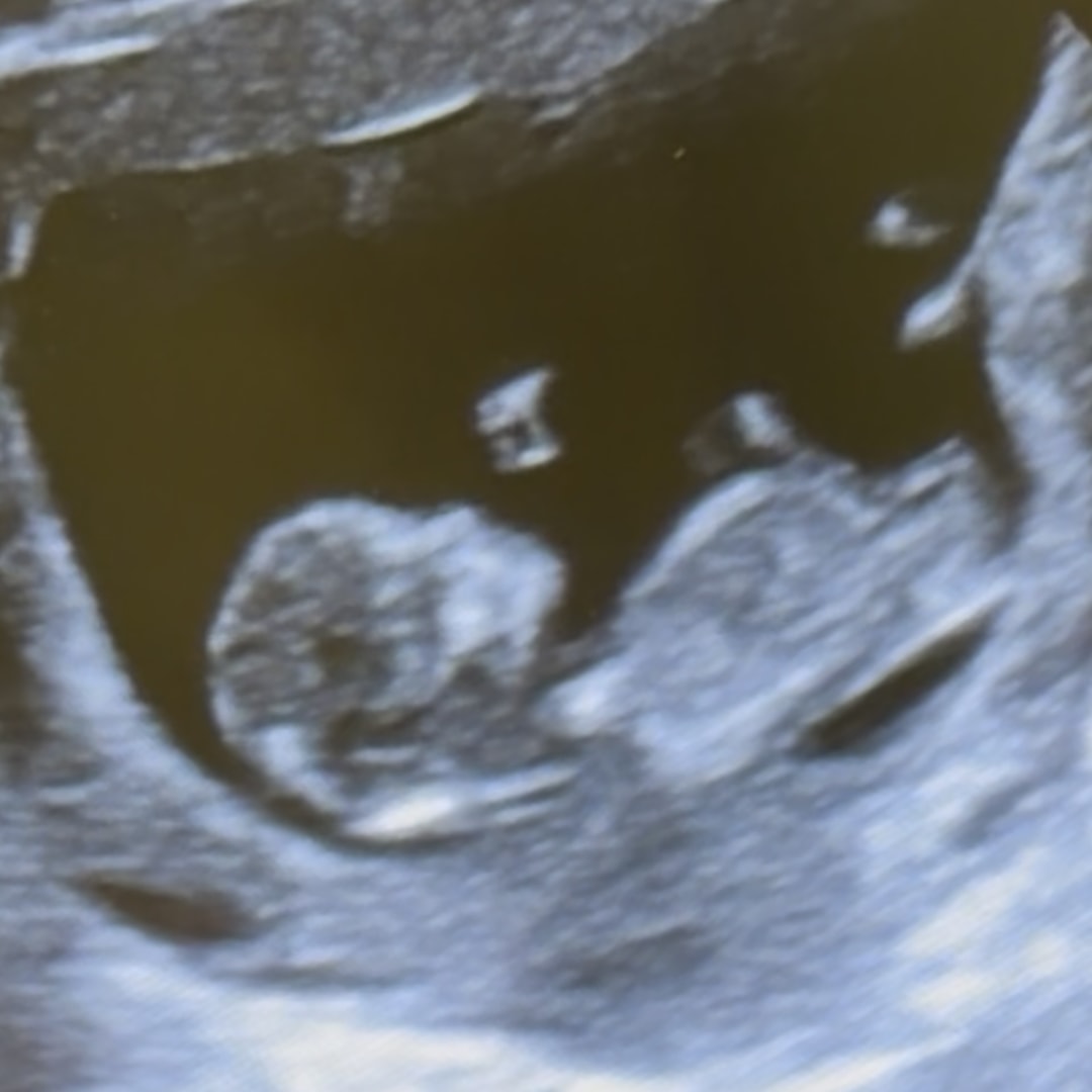 Photo shared by Olivia for their Babylist baby registry.