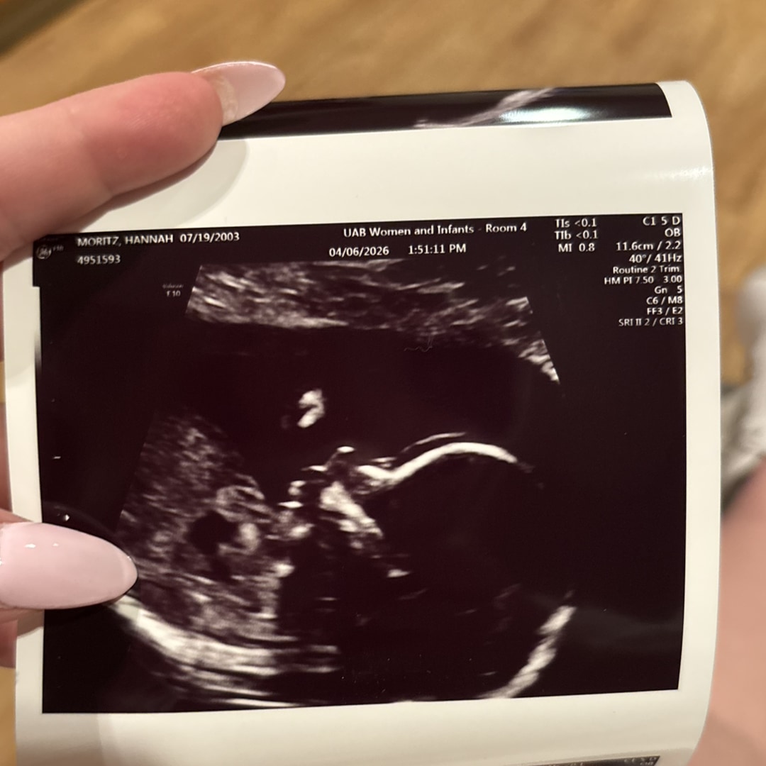 Photo shared by Hannah for their Babylist baby registry.