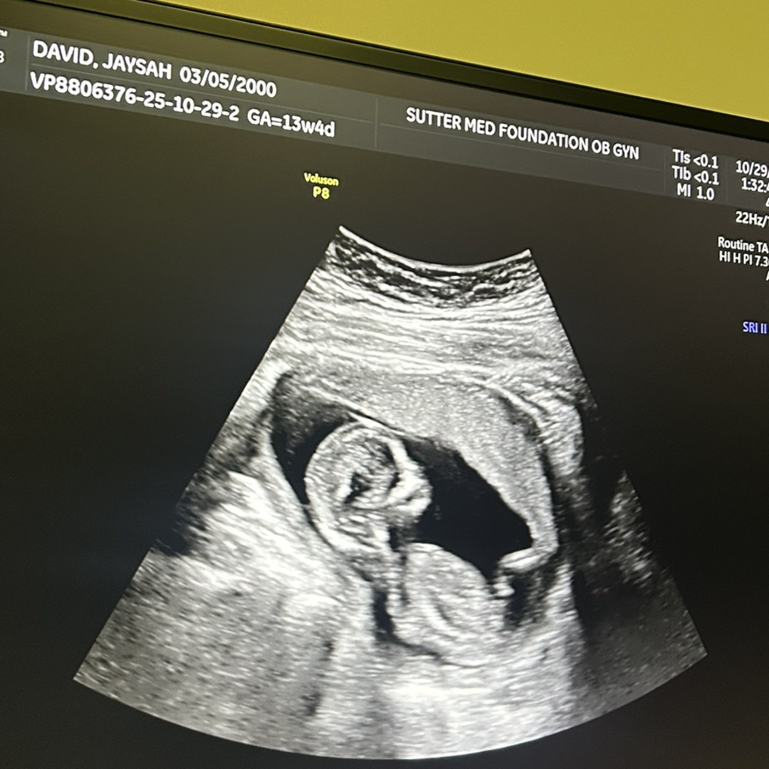 Photo shared by Jaysah for their Babylist baby registry.