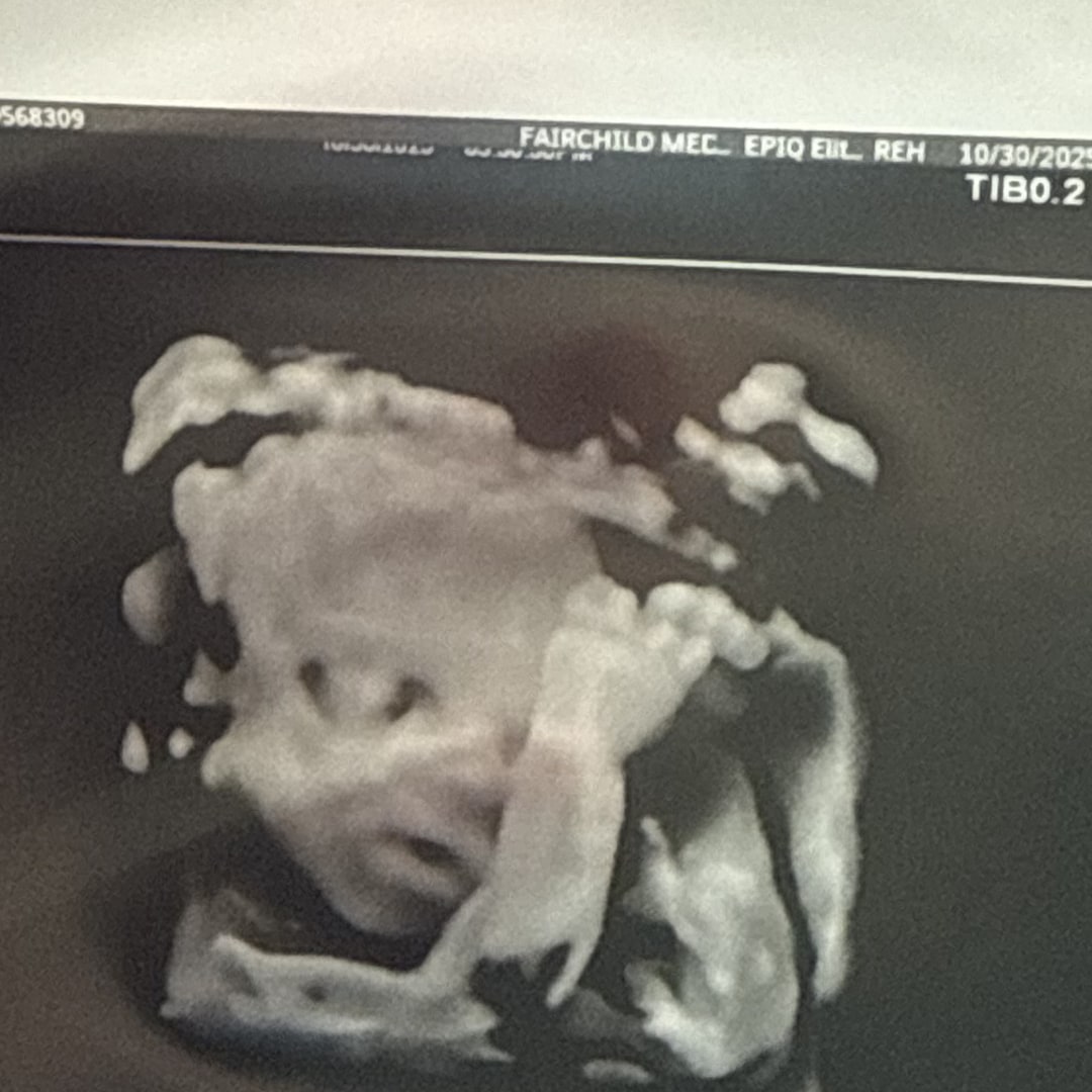 Photo shared by Kyra for their Babylist baby registry.