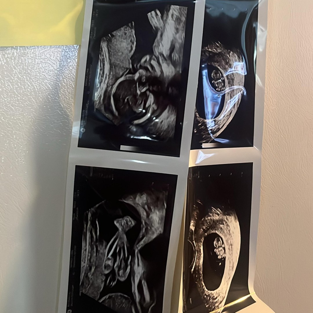 Photo shared by Coral for their Babylist baby registry.