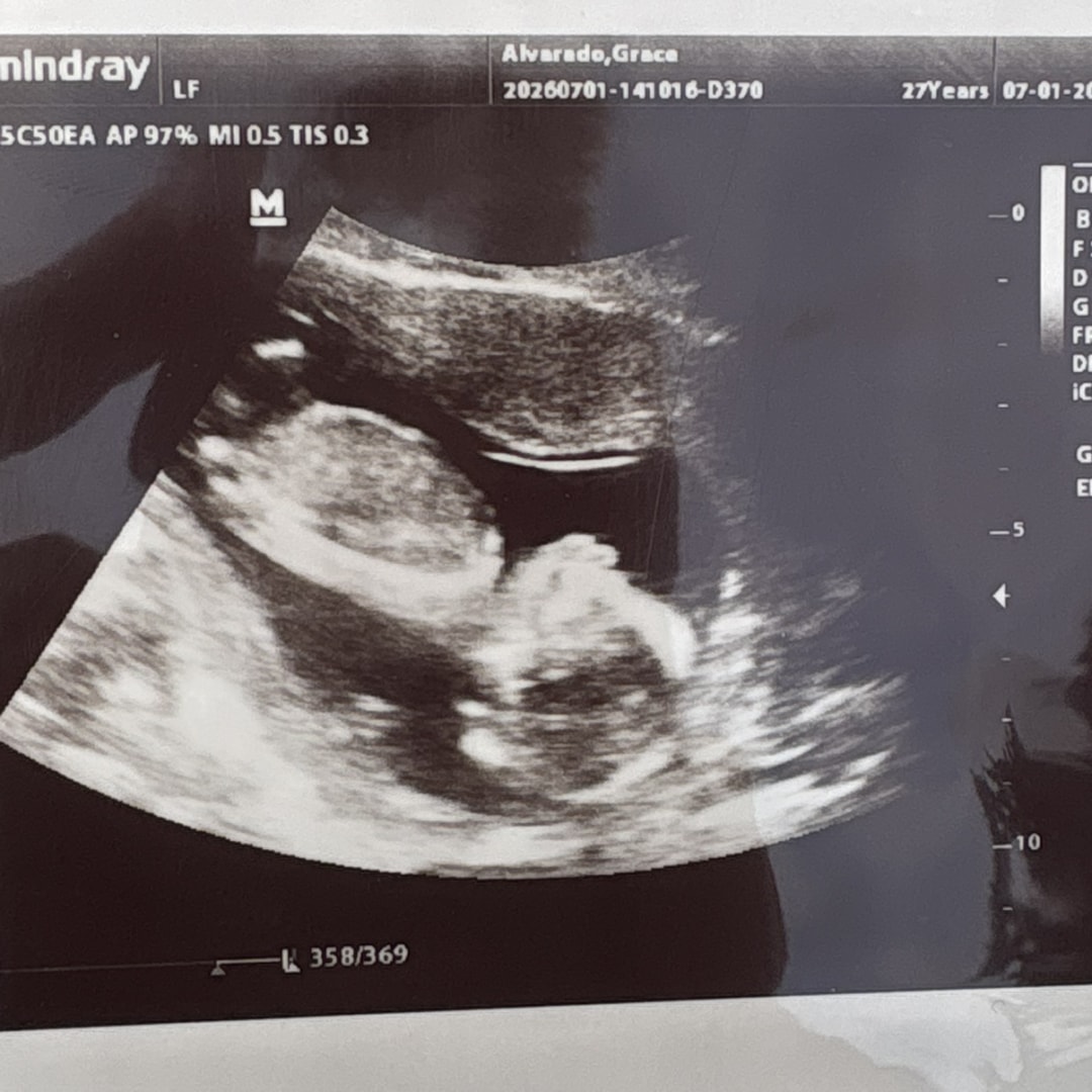 Photo shared by Gracie for their Babylist baby registry.