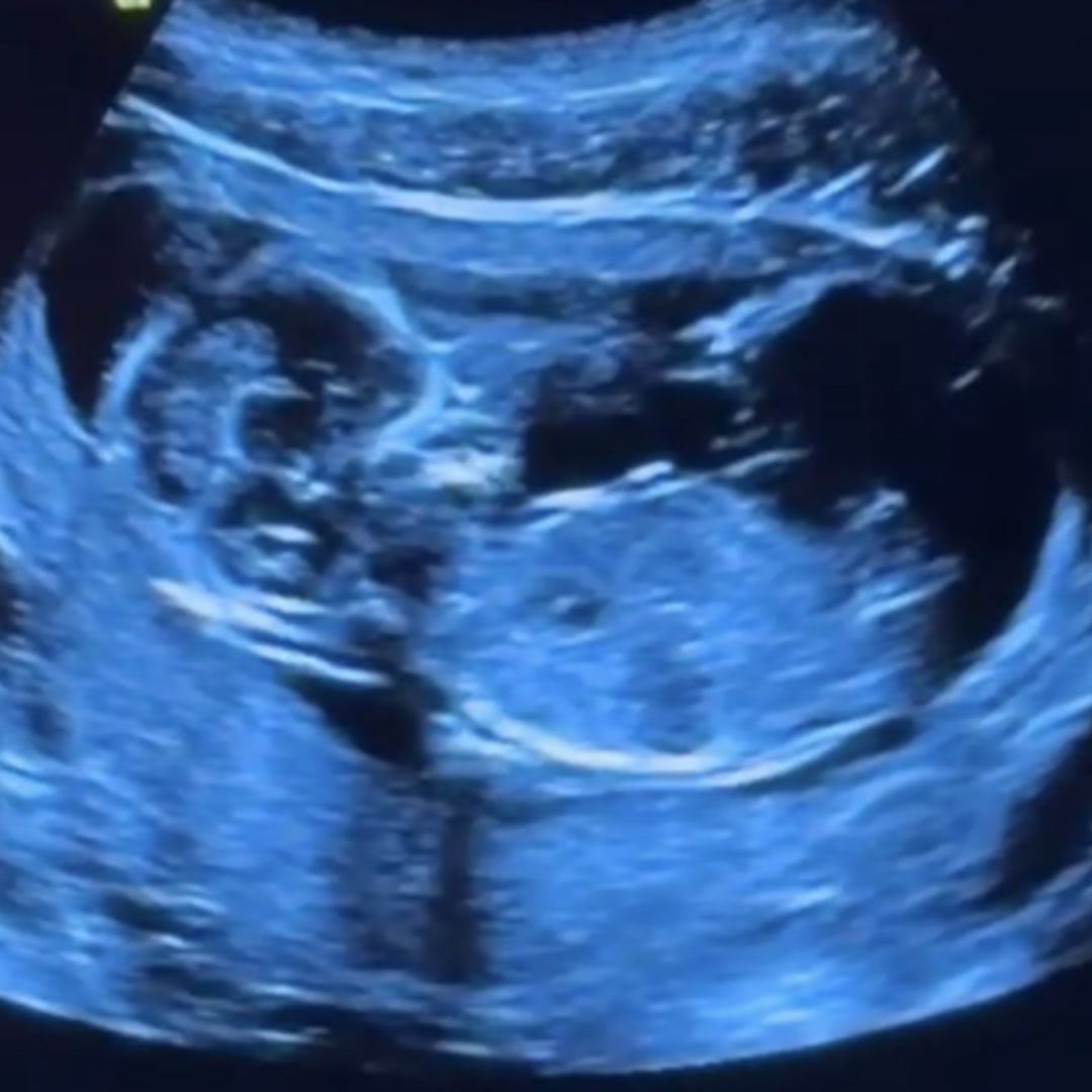 Photo shared by Antoinette for their Babylist baby registry.