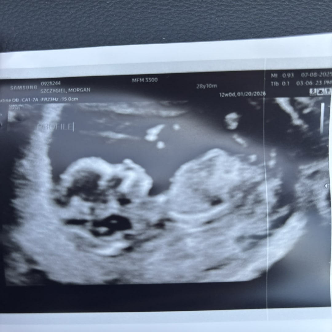 Photo shared by Morgan & Andrew for their Babylist baby registry.