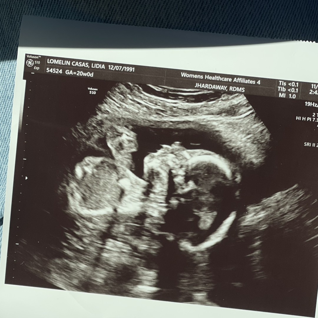 Photo shared by Lydia for their Babylist baby registry.