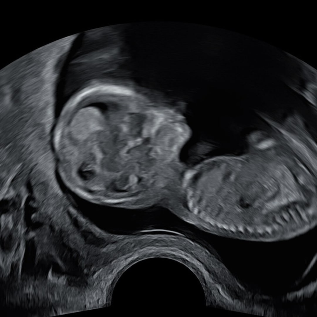 Photo shared by Amy for their Babylist baby registry.