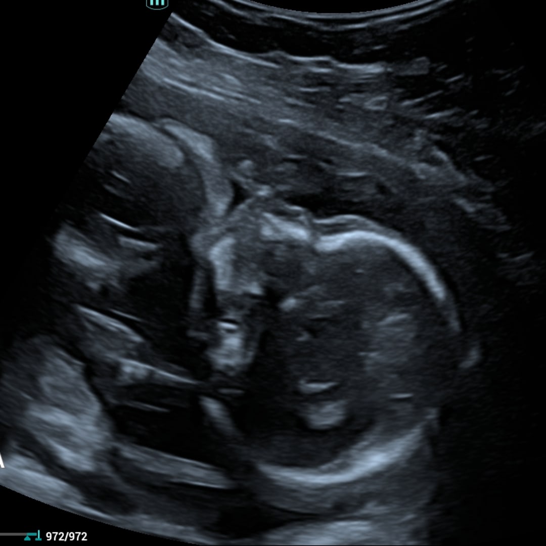 Photo shared by Starla for their Babylist baby registry.