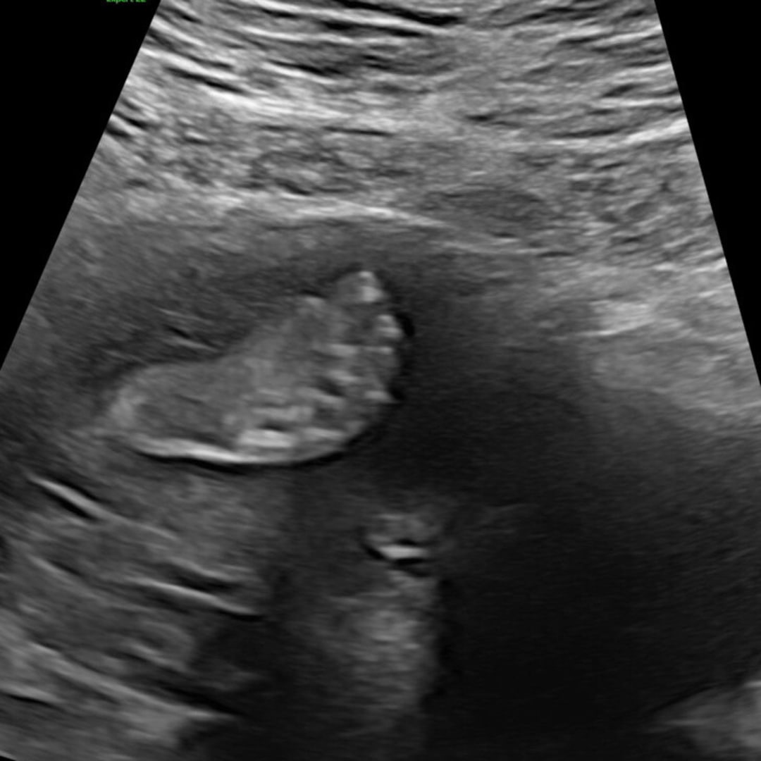 Photo shared by Ashley for their Babylist baby registry.