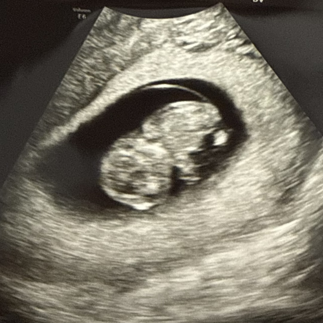 Photo shared by Naomi for their Babylist baby registry.