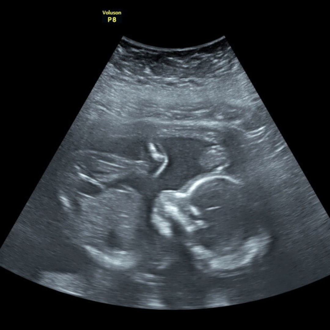 Photo shared by Hayden for their Babylist baby registry.