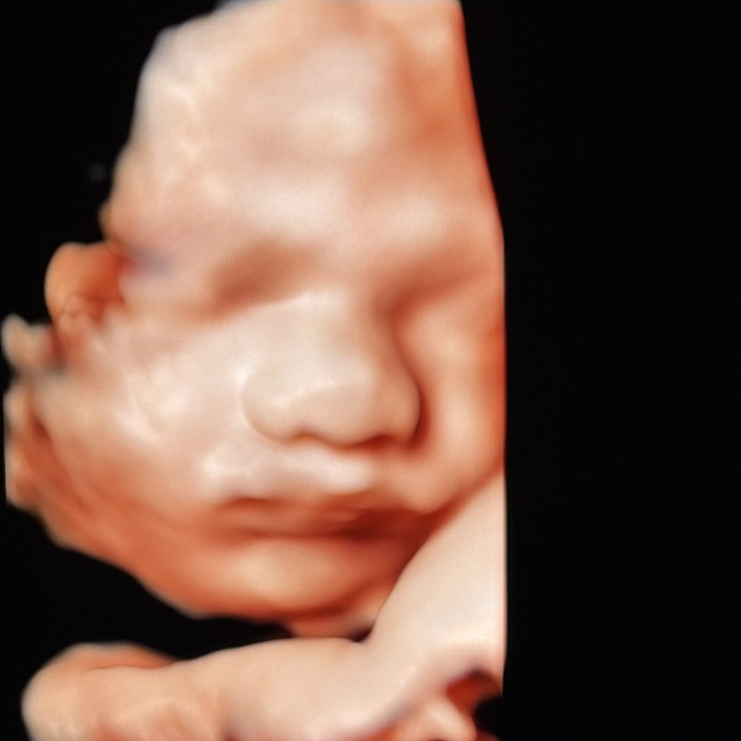 Photo shared by Rachel for their Babylist baby registry.