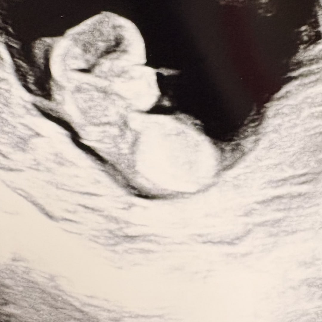 Photo shared by Niecy for their Babylist baby registry.