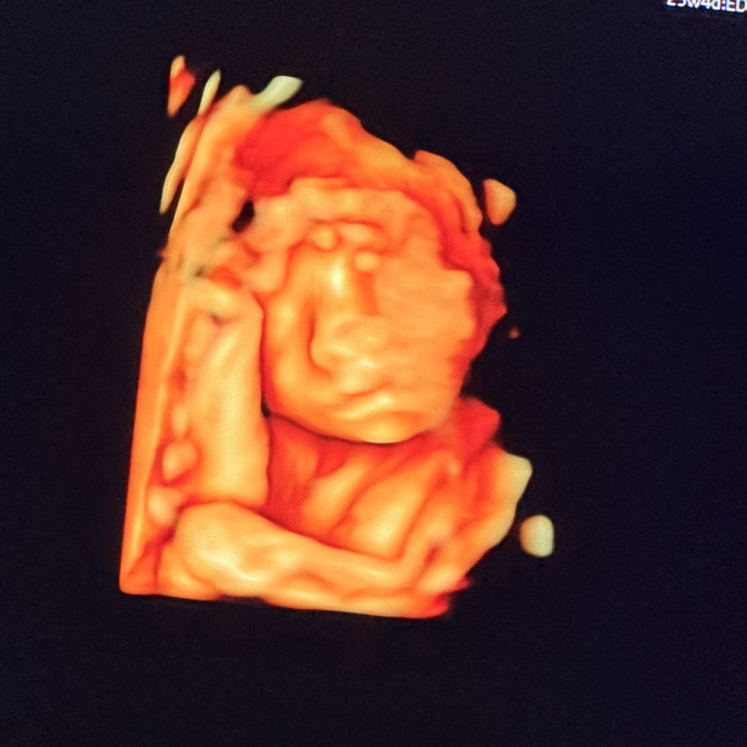 Photo shared by Anna for their Babylist baby registry.