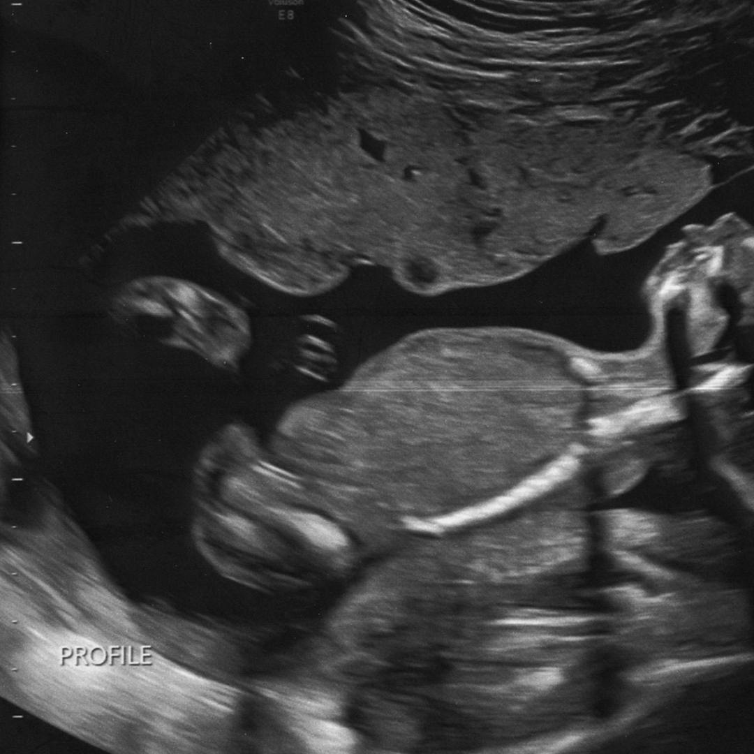 Photo shared by Kristine for their Babylist baby registry.