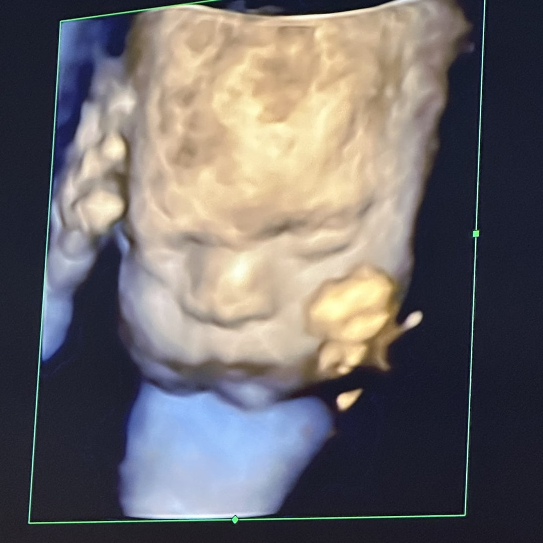 Photo shared by Anareli for their Babylist baby registry.