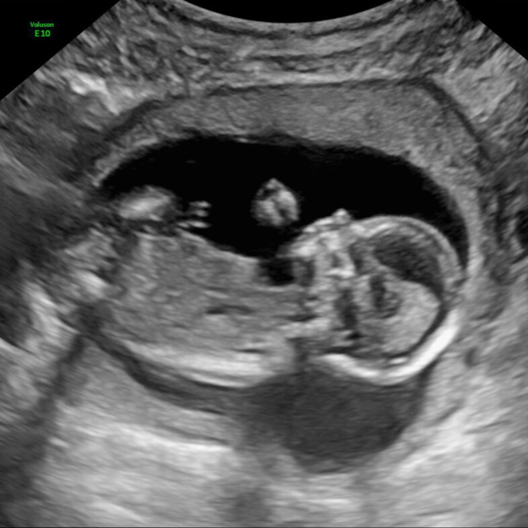 Photo shared by Itzel for their Babylist baby registry.