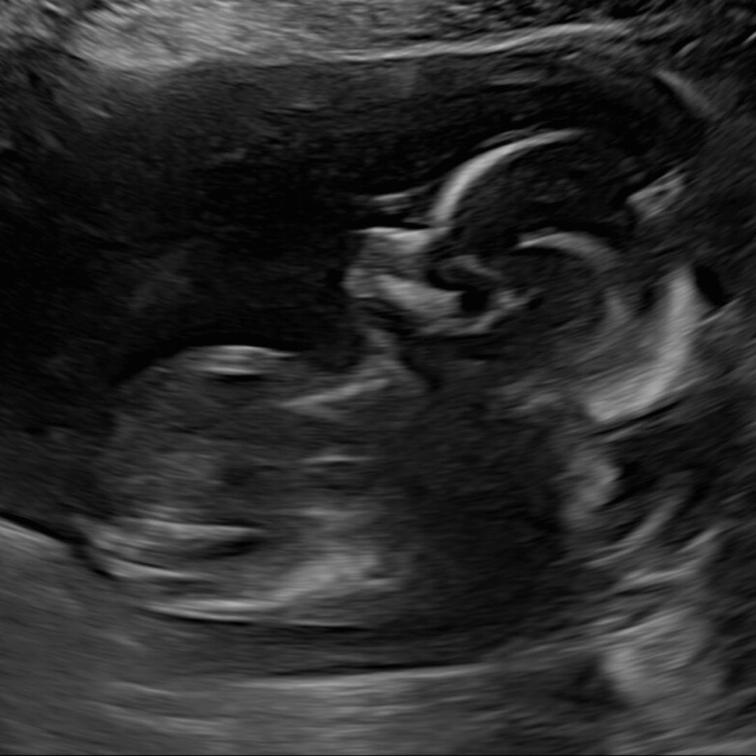 Photo shared by Kelly for their Babylist baby registry.