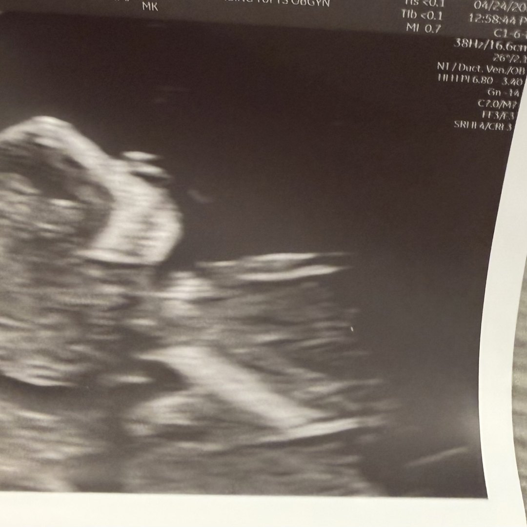 Photo shared by Margaret for their Babylist baby registry.