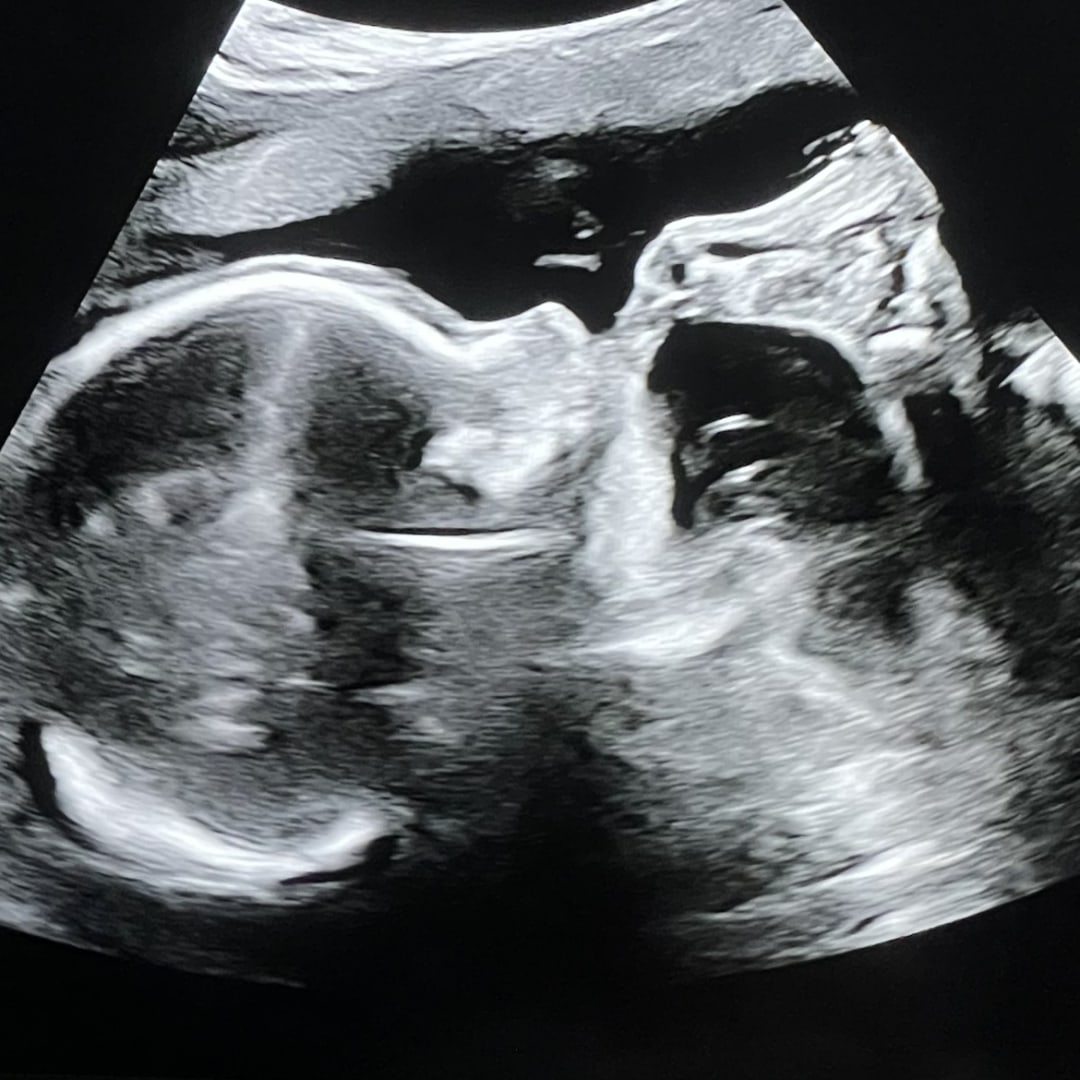 Photo shared by Kristen Ashley for their Babylist baby registry.