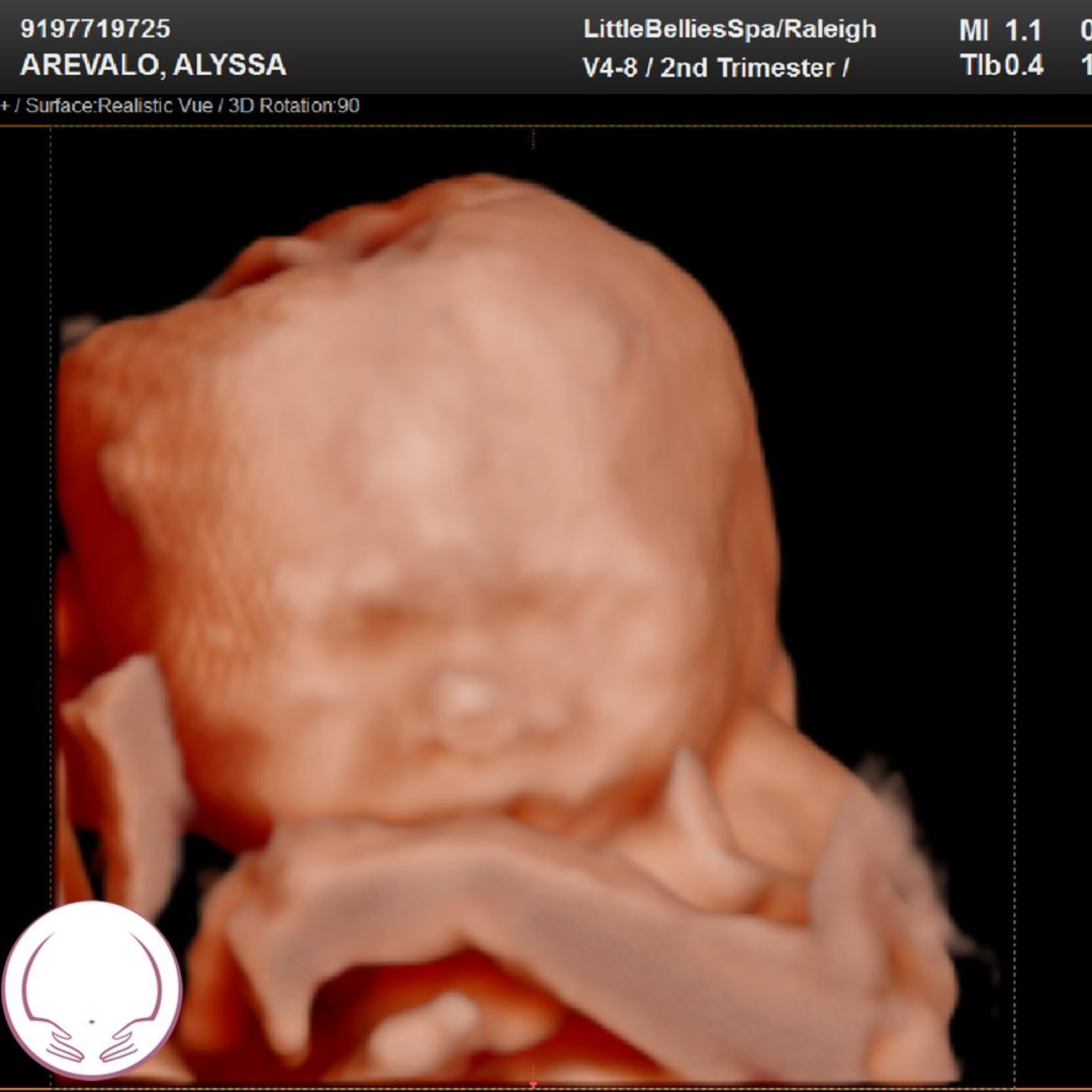 Photo shared by Alyssa for their Babylist baby registry.