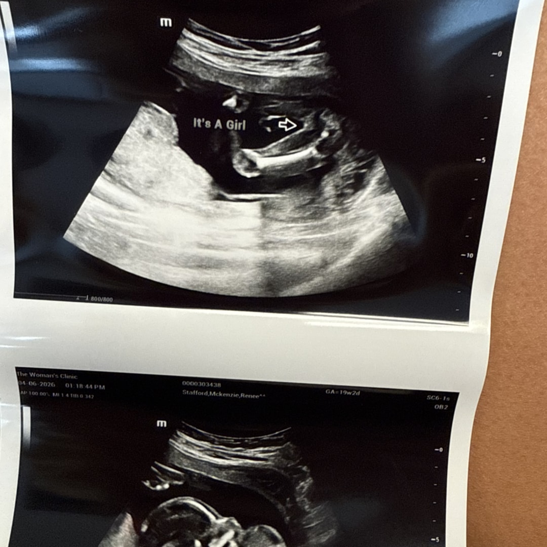 Photo shared by Mckenzie for their Babylist baby registry.