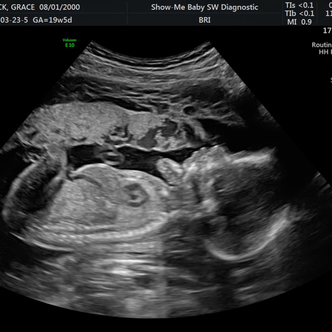 Photo shared by Grace for their Babylist baby registry.